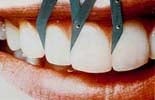 teeth measurements near you