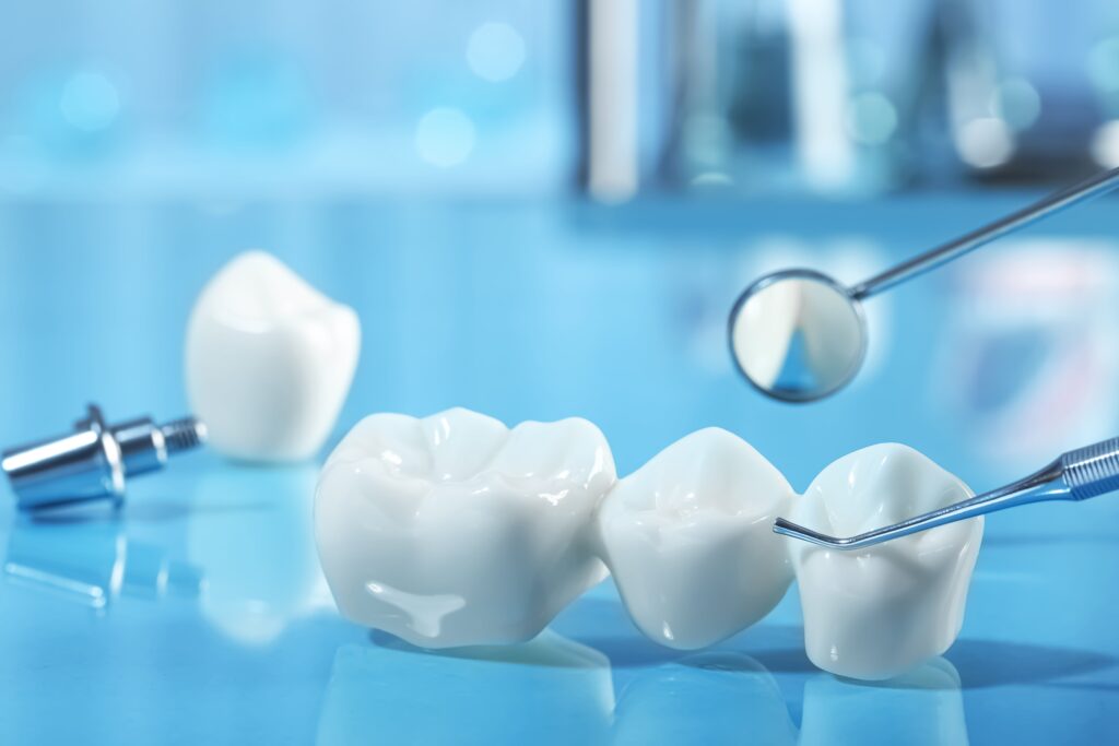 Why You May Need a Dental Crown